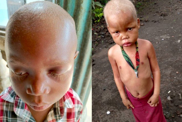 Orphelins de la guerre : à l’orphelinat Amour, des enfants meurent dans l’indifférence